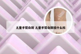 儿童手臂白斑 儿童手臂白斑挂什么科