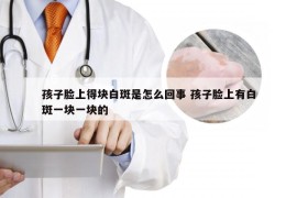 孩子脸上得块白斑是怎么回事 孩子脸上有白斑一块一块的