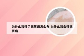 为什么我得了银屑病怎么办 为什么我会得银屑病