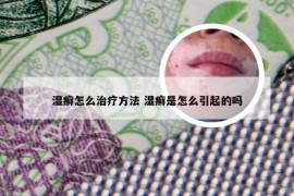 湿癣怎么治疗方法 湿癣是怎么引起的吗