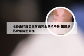 准备去印度买银屑病苏金单抗干粉 银屑病 苏金单抗怎么样