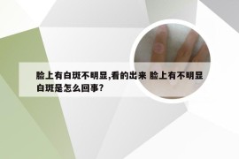 脸上有白斑不明显,看的出来 脸上有不明显白斑是怎么回事?