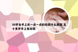 50岁女手上长一点一点的白斑什么原因 五十多岁手上有白斑