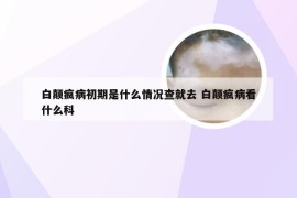 白颠疯病初期是什么情况查就去 白颠疯病看什么科