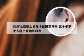 52岁女性腿上长几个白斑正常吗 五十多岁女人腿上开始长白点