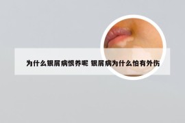 为什么银屑病恨养呢 银屑病为什么怕有外伤