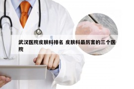 武汉医院皮肤科排名 皮肤科最厉害的三个医院