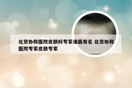 北京协和医院皮肤科专家谁最有名 北京协和医院专家皮肤专家