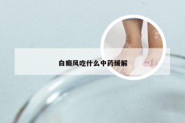 白癜风吃什么中药缓解