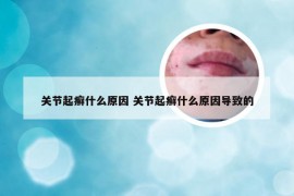 关节起癣什么原因 关节起癣什么原因导致的