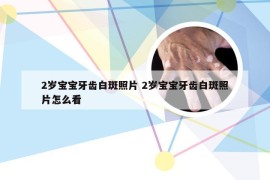 2岁宝宝牙齿白斑照片 2岁宝宝牙齿白斑照片怎么看