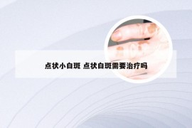 点状小白斑 点状白斑需要治疗吗