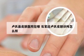 卢氏县皮肤医院在哪 石家庄卢氏皮肤诊所怎么样