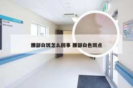 腰部白斑怎么回事 腰部白色斑点