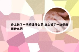 身上长了一块癣涂什么药 身上长了一块像癣用什么药