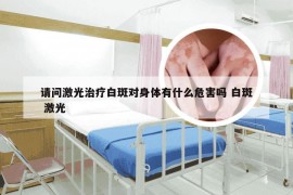 请问激光治疗白斑对身体有什么危害吗 白斑 激光