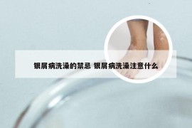 银屑病洗澡的禁忌 银屑病洗澡注意什么