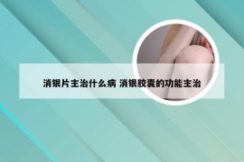 消银片主治什么病 消银胶囊的功能主治