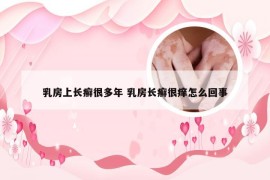 乳房上长癣很多年 乳房长癣很痒怎么回事