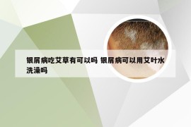 银屑病吃艾草有可以吗 银屑病可以用艾叶水洗澡吗