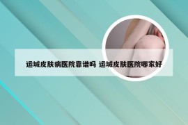 运城皮肤病医院靠谱吗 运城皮肤医院哪家好