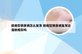 脓疱型银屑病怎么复发 脓疱型银屑病复发还是脓疱型吗