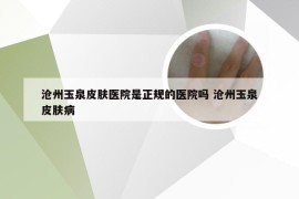 沧州玉泉皮肤医院是正规的医院吗 沧州玉泉皮肤病