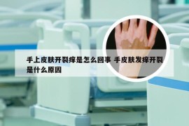 手上皮肤开裂痒是怎么回事 手皮肤发痒开裂是什么原因