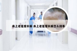 身上老是爱长癣 身上老是爱长癣怎么回事