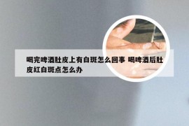 喝完啤酒肚皮上有白斑怎么回事 喝啤酒后肚皮红白斑点怎么办