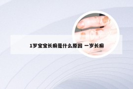 1岁宝宝长癣是什么原因 一岁长癣