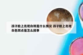 孩子脸上出现白斑是什么情况 孩子脸上出现白色斑点是怎么回事