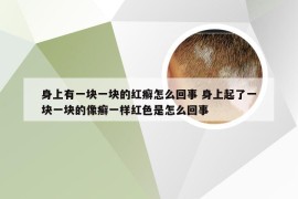 身上有一块一块的红癣怎么回事 身上起了一块一块的像癣一样红色是怎么回事