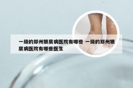 一级的郑州银屑病医院有哪些 一级的郑州银屑病医院有哪些医生