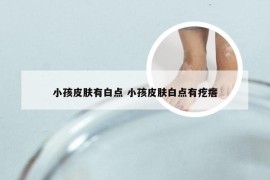 小孩皮肤有白点 小孩皮肤白点有疙瘩