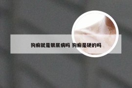 狗癣就是银屑病吗 狗癣是硬的吗