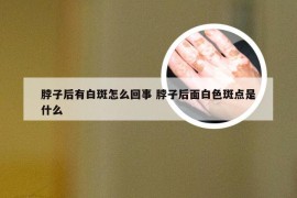 脖子后有白斑怎么回事 脖子后面白色斑点是什么