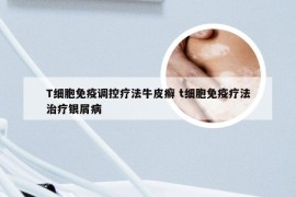 T细胞免疫调控疗法牛皮癣 t细胞免疫疗法治疗银屑病