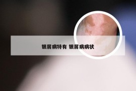 银屑病特有 银屑病病状