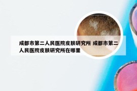 成都市第二人民医院皮肤研究所 成都市第二人民医院皮肤研究所在哪里