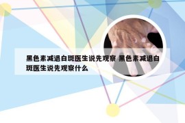 黑色素减退白斑医生说先观察 黑色素减退白斑医生说先观察什么