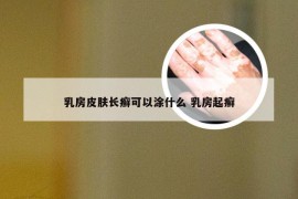 乳房皮肤长癣可以涂什么 乳房起癣