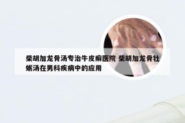 柴胡加龙骨汤专治牛皮癣医院 柴胡加龙骨牡蛎汤在男科疾病中的应用