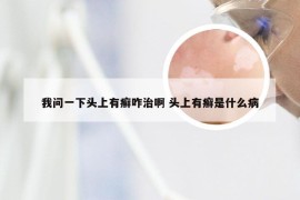 我问一下头上有癣咋治啊 头上有癣是什么病