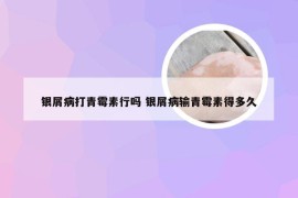 银屑病打青霉素行吗 银屑病输青霉素得多久