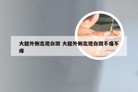 大腿外侧出现白斑 大腿外侧出现白斑不痛不痒