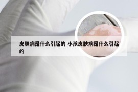 皮肤病是什么引起的 小孩皮肤病是什么引起的