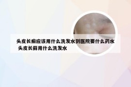 头皮长癣应该用什么洗发水到医院要什么药水 头皮长藓用什么洗发水