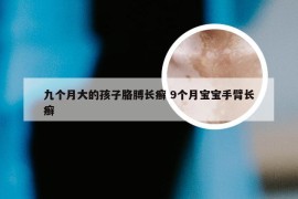 九个月大的孩子胳膊长癣 9个月宝宝手臂长癣