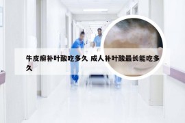 牛皮癣补叶酸吃多久 成人补叶酸最长能吃多久